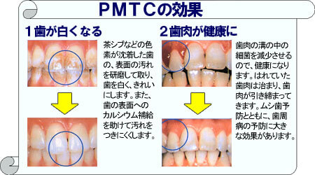 PMTC